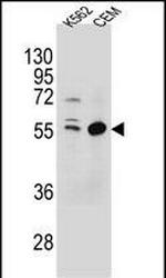 TEX9 Antibody in Western Blot (WB)