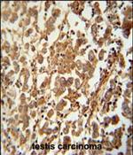 SPATC1 Polyclonal Antibody