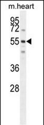 SPATC1 Antibody in Western Blot (WB)