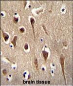 FBXO39 Polyclonal Antibody
