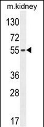FBXO39 Antibody in Western Blot (WB)