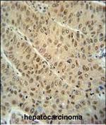 WDR32 Polyclonal Antibody