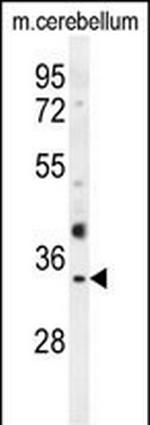 Olfr640 Polyclonal Antibody