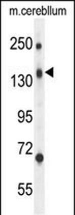 CD109 Polyclonal Antibody