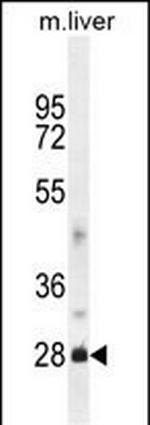 DNAJB8 Polyclonal Antibody