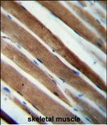 CCDC38 Polyclonal Antibody