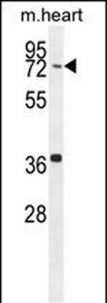 CCDC38 Antibody in Western Blot (WB)
