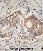 HHLA2 Antibody in Immunohistochemistry (Paraffin) (IHC (P))