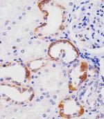 HHLA2 Antibody in Immunohistochemistry (Paraffin) (IHC (P))