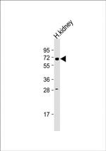 HHLA2 Antibody in Western Blot (WB)