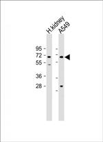 HHLA2 Antibody in Western Blot (WB)