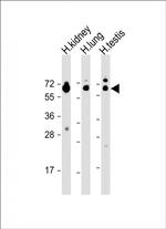 HHLA2 Antibody in Western Blot (WB)