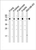 HHLA2 Antibody in Western Blot (WB)