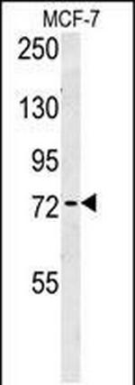 RICH2 Antibody in Western Blot (WB)