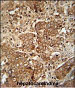 Serum Amyloid P Polyclonal Antibody
