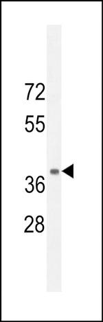 NPSR1 Polyclonal Antibody