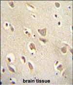 MCHR1 Polyclonal Antibody