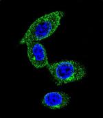 SORBS1 Polyclonal Antibody