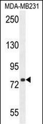 SORBS1 Antibody in Western Blot (WB)
