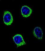 alpha Amylase 2B Polyclonal Antibody