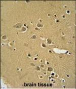 alpha Amylase 2B Antibody in Immunohistochemistry (Paraffin) (IHC (P))
