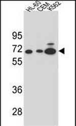 alpha Amylase 2B Antibody in Western Blot (WB)