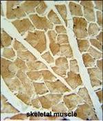 ARHGAP10 Polyclonal Antibody