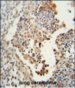 CADM1 Polyclonal Antibody