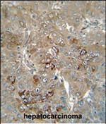 CES4 Polyclonal Antibody