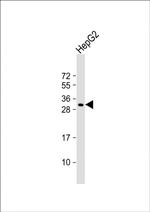 CES4 Antibody in Western Blot (WB)