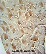 COX10 Polyclonal Antibody