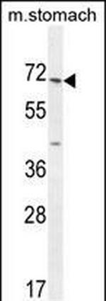 ESCO2 Polyclonal Antibody