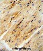 GPD1L Polyclonal Antibody