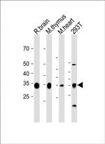 GPD1L Antibody in Western Blot (WB)