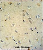 GluR4 Polyclonal Antibody