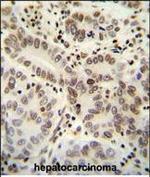 HIST1H2BJ Polyclonal Antibody