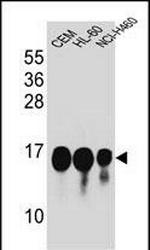 HIST1H2BJ Antibody in Western Blot (WB)