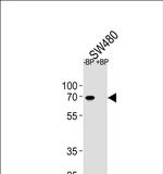 ETV5 Polyclonal Antibody