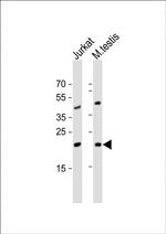 ORMDL3 Polyclonal Antibody