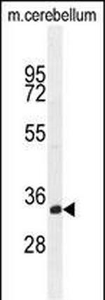 TMEM66 Polyclonal Antibody