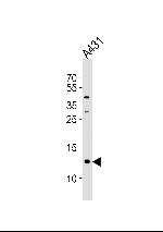 SPRR2A Polyclonal Antibody