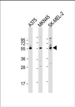 GSDMC Antibody in Western Blot (WB)