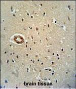 CWC22 Polyclonal Antibody