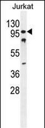 CWC22 Antibody in Western Blot (WB)