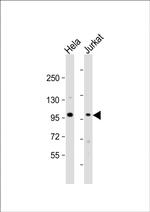 NSUN2 Polyclonal Antibody