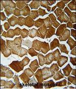 ORMDL2 Polyclonal Antibody