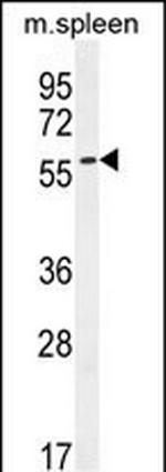 POC5 Polyclonal Antibody