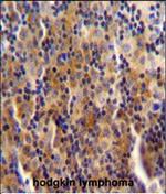 SYNE3 Polyclonal Antibody