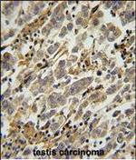 ASB17 Antibody in Immunohistochemistry (Paraffin) (IHC (P))
