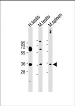 ASB17 Antibody in Western Blot (WB)